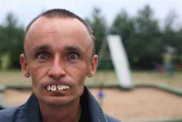 Głebokie zdziwienie podentystyczne